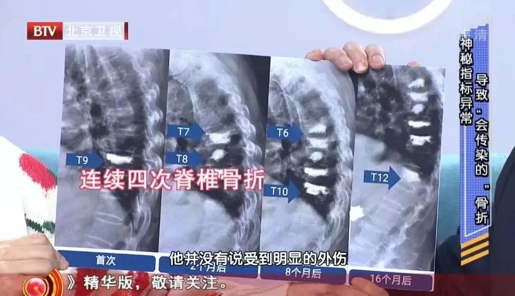 泡茶超过时间了好不好,喝哪种茶对身体的钙流失最小