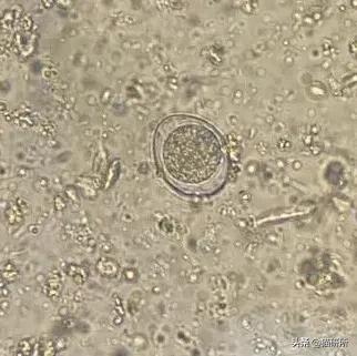 显微镜下的猫屎，竟然和这么多食物都撞脸？