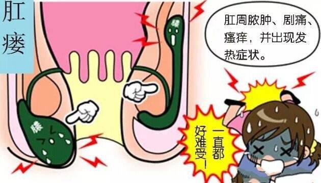 5个月宝宝得了肛瘘需要手术吗,3个月的宝宝肛瘘能自愈吗