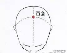 气虚型冠心病缓不过来气的急救穴,中医对心脏病的急救用穴是哪几个