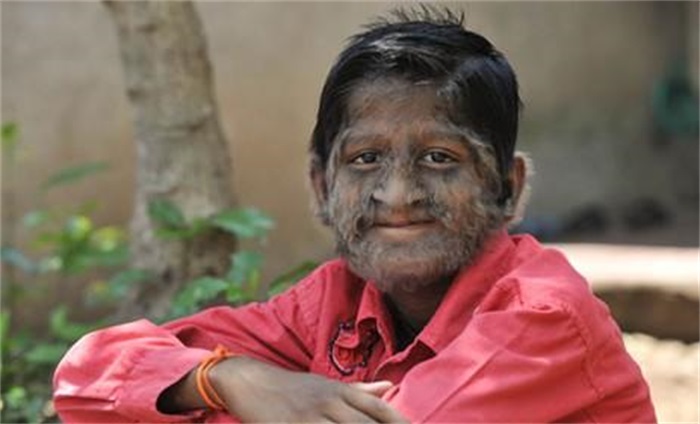 脱毛为啥?114万年前人类褪毛,只剩阴毛、头发等,究竟有啥用?