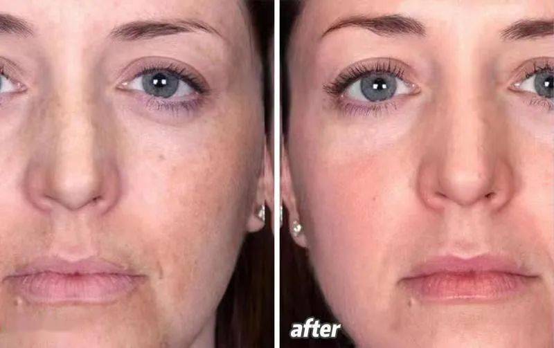 奥运选手都做了美甲,奥运换头选手