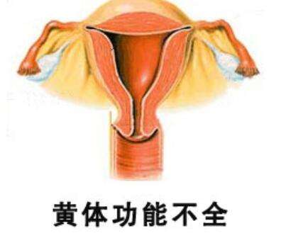 内分泌失调黄体功能不足症状,怀孕黄体不足的症状表现