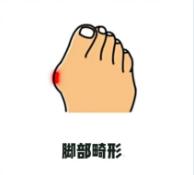 年龄大了穿鞋磨脚侧面,年龄大了穿鞋累脚