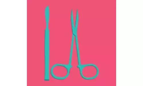 避孕有哪些方法不上环,经期避孕和安全套避孕