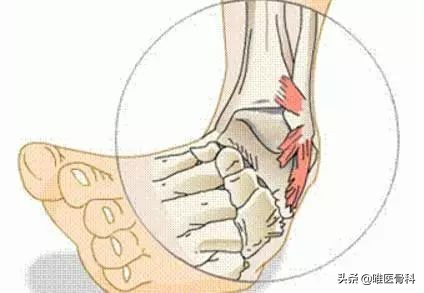 旅行走久了腰疼,旅行带来的后遗症