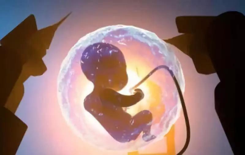 孕4月胎停育有什么症状,12周胎停育有什么症状