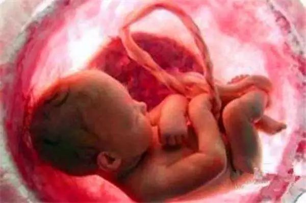 早产儿一般早产多久才是危险,早产后注意事项有哪些