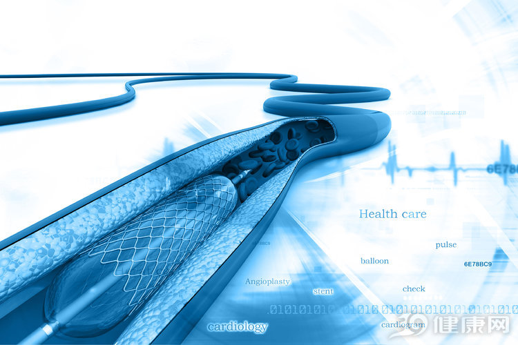 做完心脏支架为什么会发生心颤,心血管堵了80%一定要做支架吗