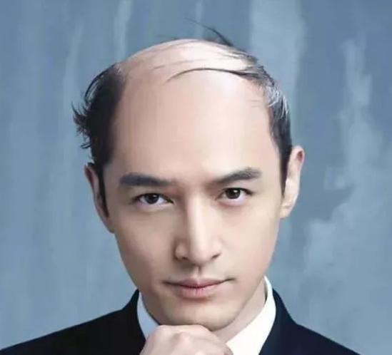 猫咪掉毛严重的原因及解决办法,猫咪掉毛怎么办这5个方法帮助你