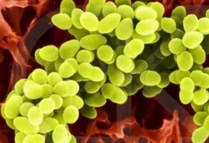 食物中毒上吐下泻吃益生菌可以吗,益生菌食物中毒