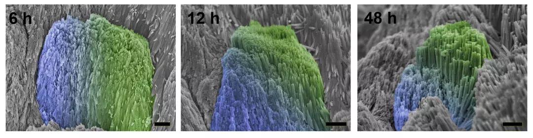 牙齿牙釉质缺损的修复方式,牙齿缺损自己修复
