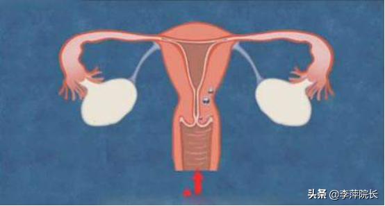 子宫颈息肉能影响怀孕吗