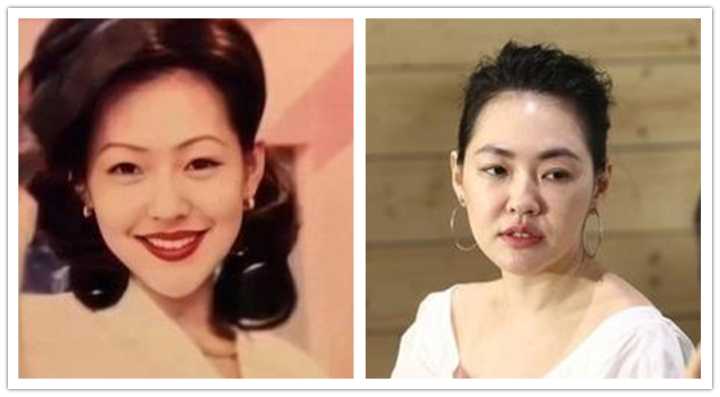 咬肌型发腮怎么改善,大脸方脸女生如何快速改变脸型