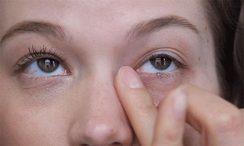 祛除眼袋的小妙招红霉素软膏,用什么可以祛除黑眼圈和眼袋