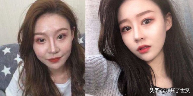 石原里美和佐藤健,石原里美整容之路