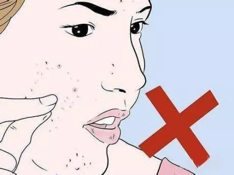 腋下痘痘挤出白色米粒是什么,痘痘里面挤出小米粒是不是就好了