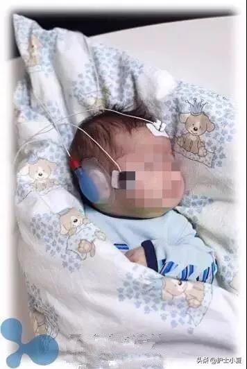 新生儿听力障碍是什么原因导致的,新生儿听力损害高危儿