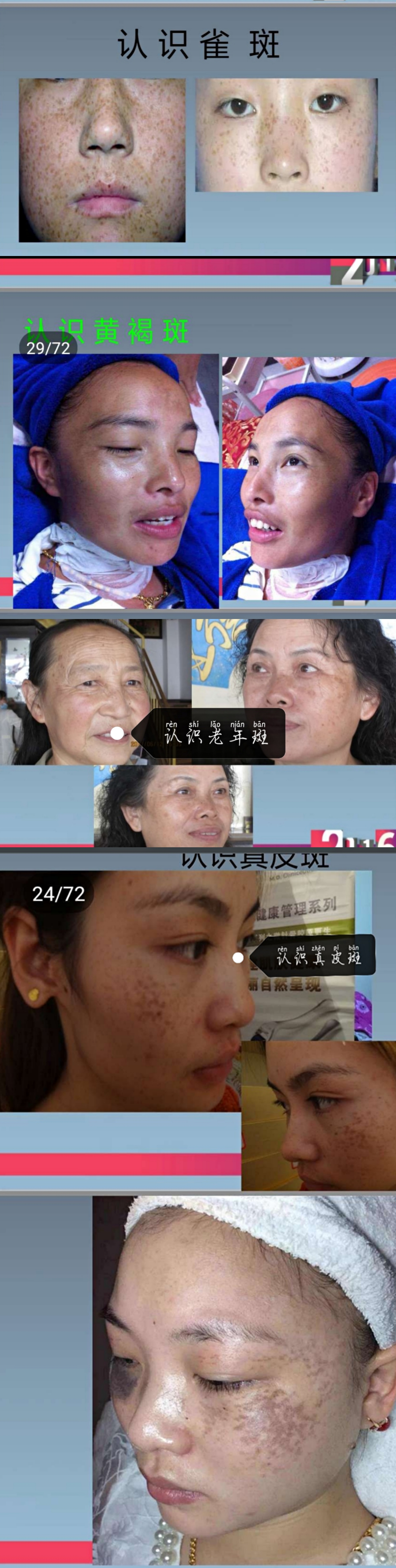 摘掉口罩瞬间毁颜值,摘下口罩的瞬间你有没有吓到