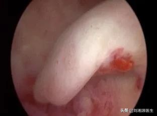 免疫不良妊娠可以通过中药治疗吗,免疫相关不良妊娠答疑解惑