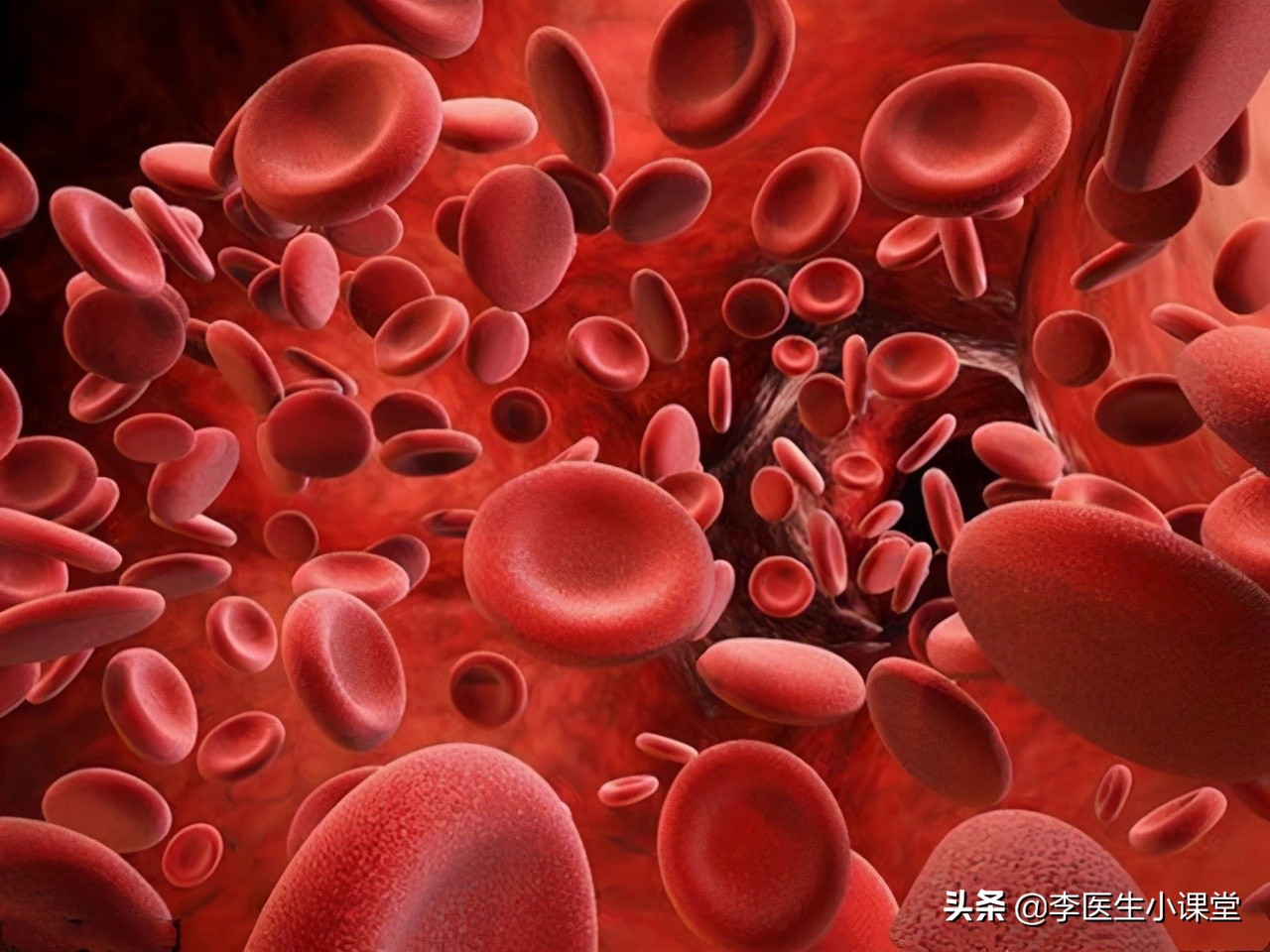 拔罐后罐印上有白点怎么回事,拔罐出现淤青是怎么回事