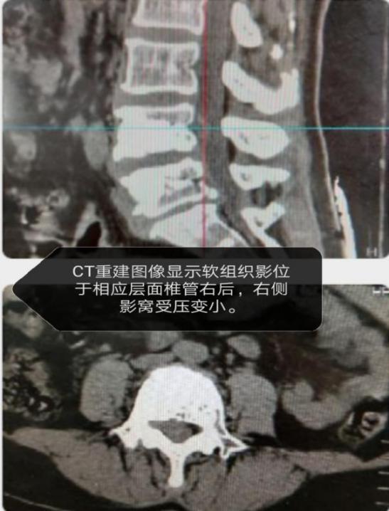 那天，市第二人民医院收到一件特殊的包裹……