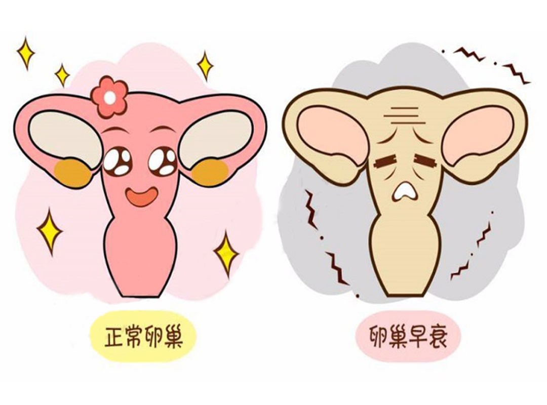 卵巢功能下降怎么调用什么中成药,多囊卵巢和卵巢储备功能下降