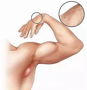 辟谣:养猫会得猫抓热?猫抓热到底是什么病?你家猫咪患上了吗?