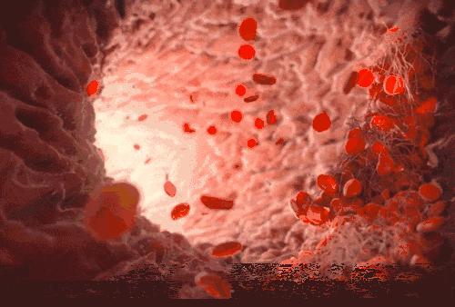 体检发现贫血却查出肠癌,贫血体检怎么做才过关