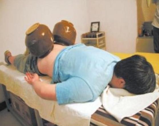 一种治疗腰突的方法,最新腰突治疗手段