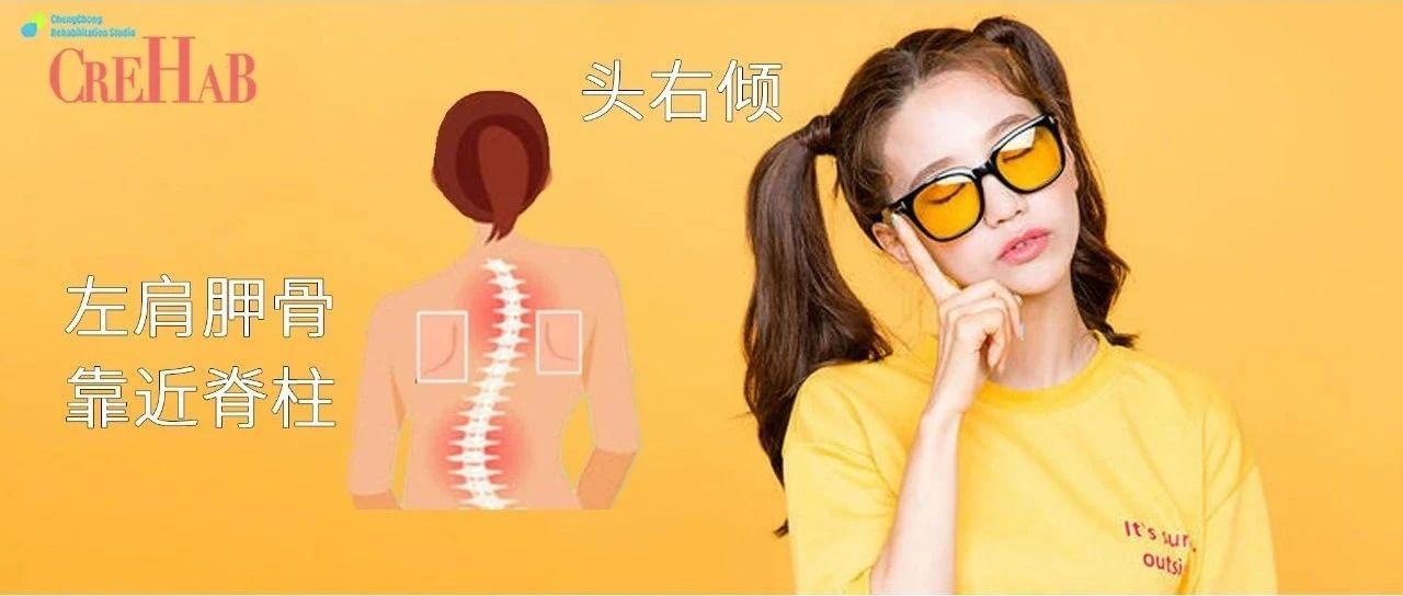 脖子斜颈锻炼方法,斜颈怎么提升脖子的力量