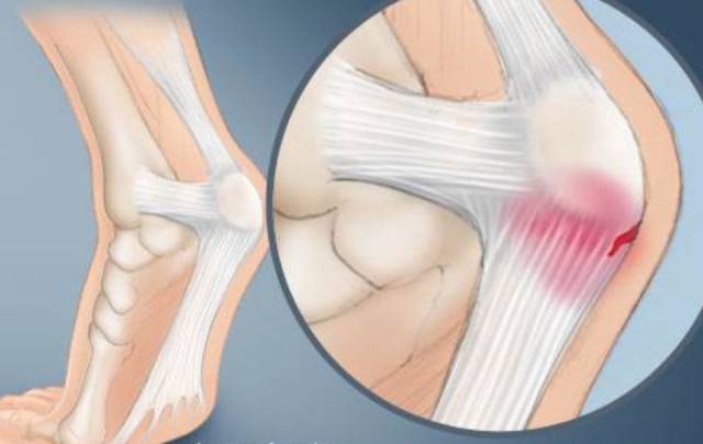 针刀治疗的目的是什么,针刀治疗有什么用