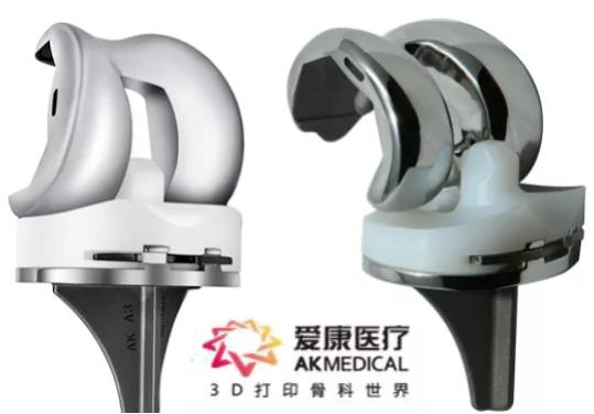 世界首例3d打印骨植入,华西医院假体植入