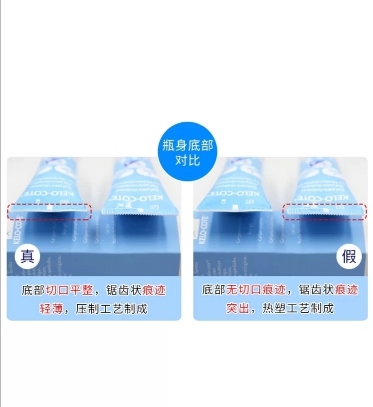 你用过最好的祛疤方法,小红书推荐祛疤真的有效吗