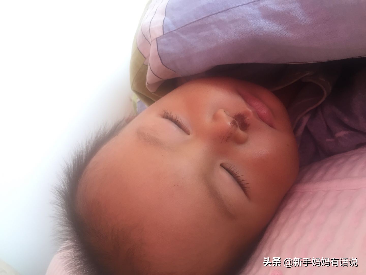 一岁多的宝宝得了鼻炎怎么办,一岁半宝宝鼻炎有哪些表现