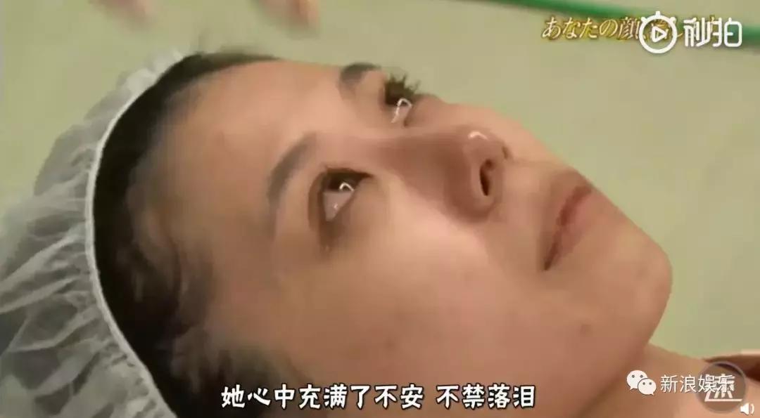 那些整容脸真的觉得自己好看吗,为什么整容以后都是一样的网红脸