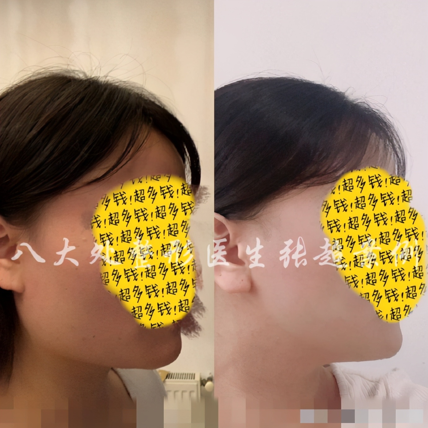 八大处张超抖音,八大处张超合集