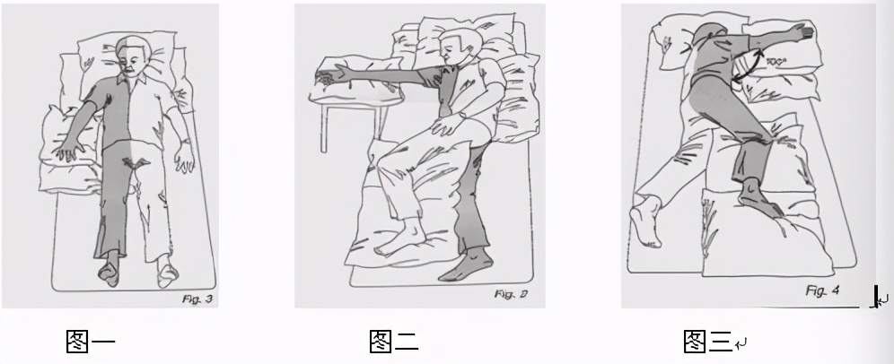 65％脑梗患者会出现痉挛现象，4大方法降低肌张力，缓解痉挛