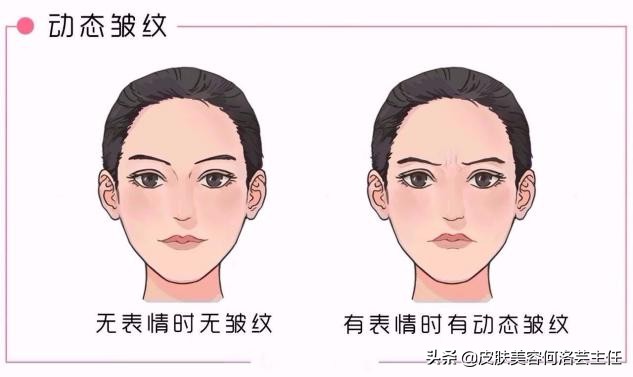 长皱纹多了用什么方法去皱纹最好,长皱纹了怎么救