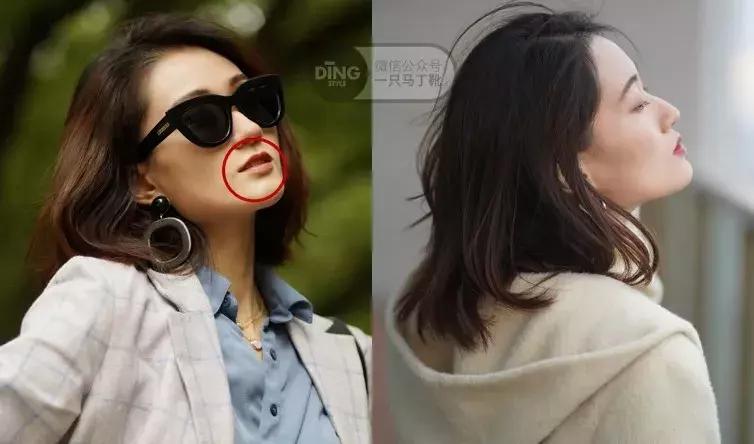 为了变美去整容,整牙堪比整容聊聊我的亲身经历