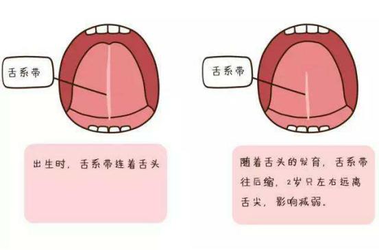 小孩说话晚要怎么做才能会说话,小孩晚说话好还是早说话好