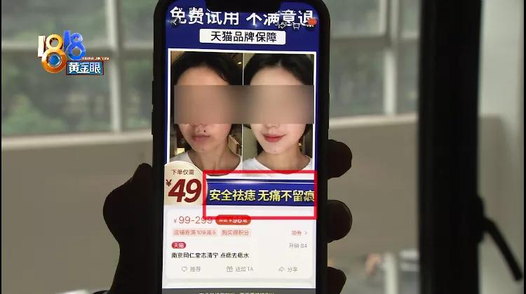 化学药物点痣留下疤,皮肤抑菌膏祛痣