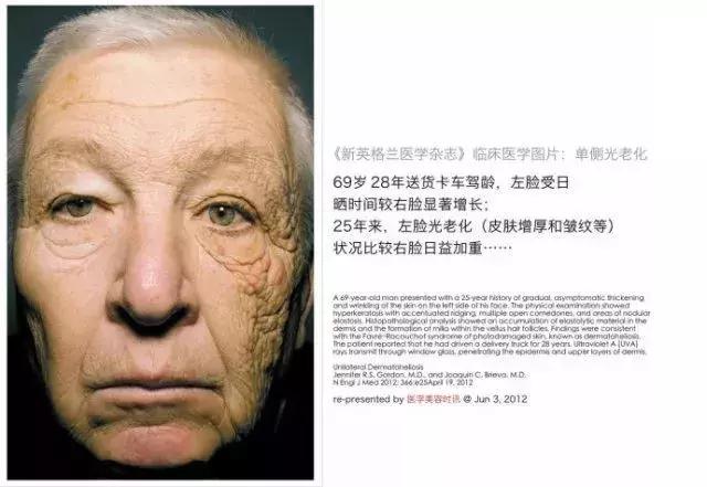 明星童颜秘诀，每1秒卖出10瓶的TA，素人高呼有效淡纹、去暗沉！