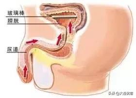 为什么女生尿尿需要纸巾擦，而男生不用？不能学男生抖抖吗？