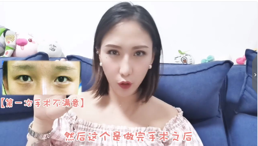 做双眼皮医生不会告诉你的真相,武汉割双眼皮亲身经历