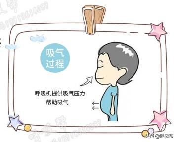 瑞思迈呼吸机型号区别图片,瑞思迈呼吸机型号及价格