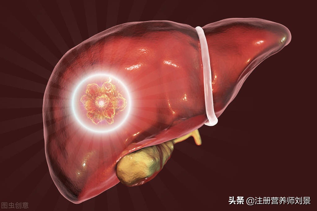 体检发现肝囊肿和脂肪肝,肝囊肿需要护肝治疗吗