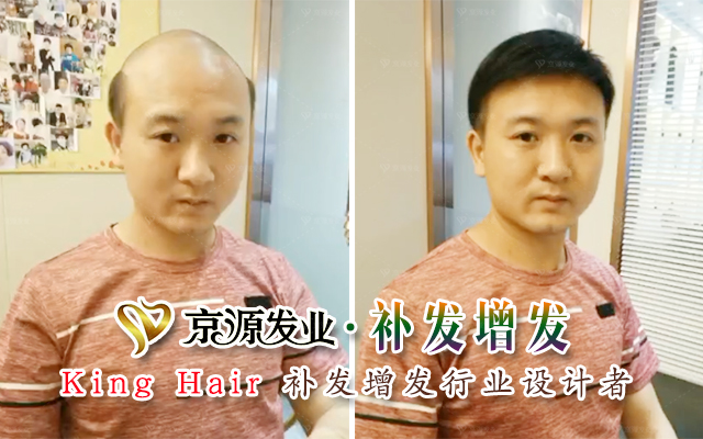自然款男士假发打理,男士假发佩戴逼真更自然