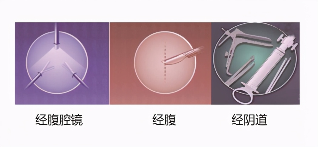 医生科普子宫,科普切除子宫的危害有哪些