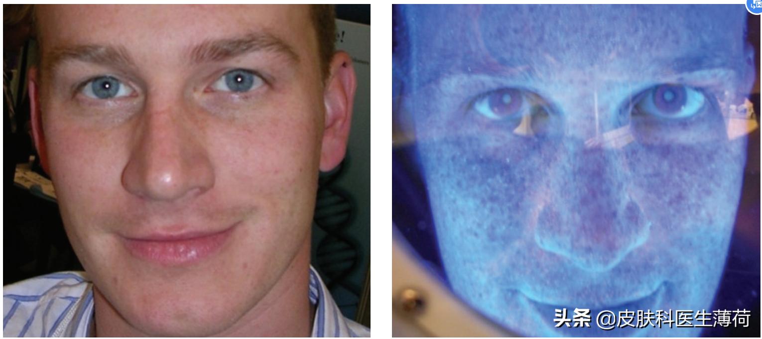 如何防止光老化氧化,预防光老化的最佳方法